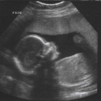 Сучасний ультразвуковий сканер в Білій Церкві