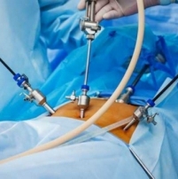 Запрацювала лапароскопічна стійка